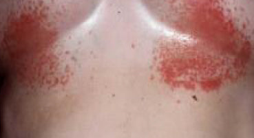 THERAPEUTIX WASH & WEAR BRA SWEAT LINER